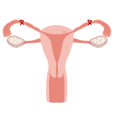 Permanent Birth Control Methods Tubal Ligation